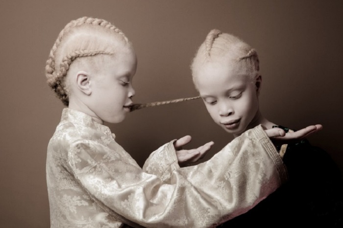 Эти близняшки взорвали Интернет своей феноменальной внешностью.