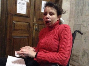 В оппозиции считают нападение на Татьяну Чорновол покушением на убийство