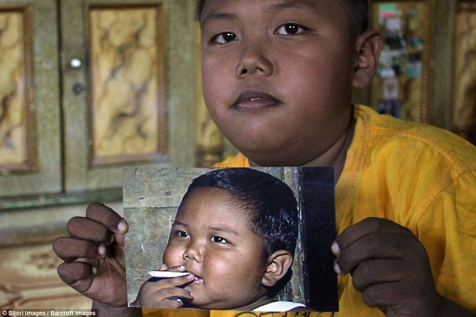 В 2 года по 40 сигарет. Самый юный курильщик в мире поразил изменениями во внешности