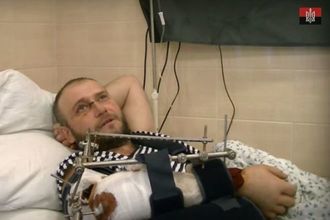 Раненого Дмитрия Яроша прооперируют израильские медики