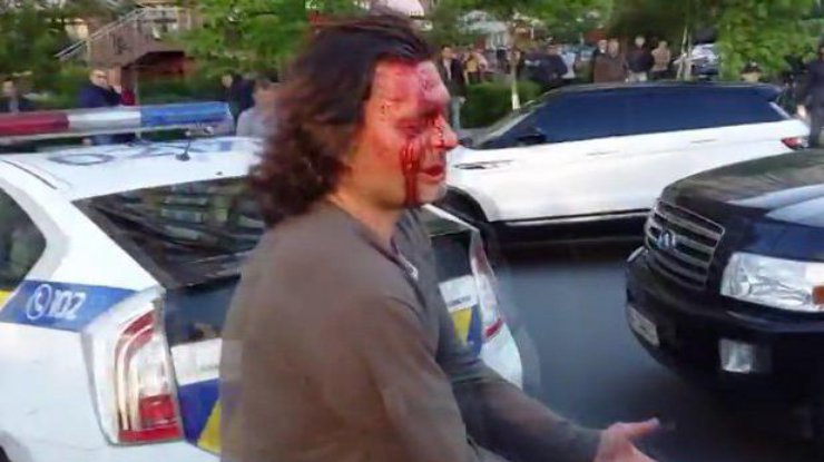 В Киеве полиция при задержании разбила голову олимпийскому чемпиону