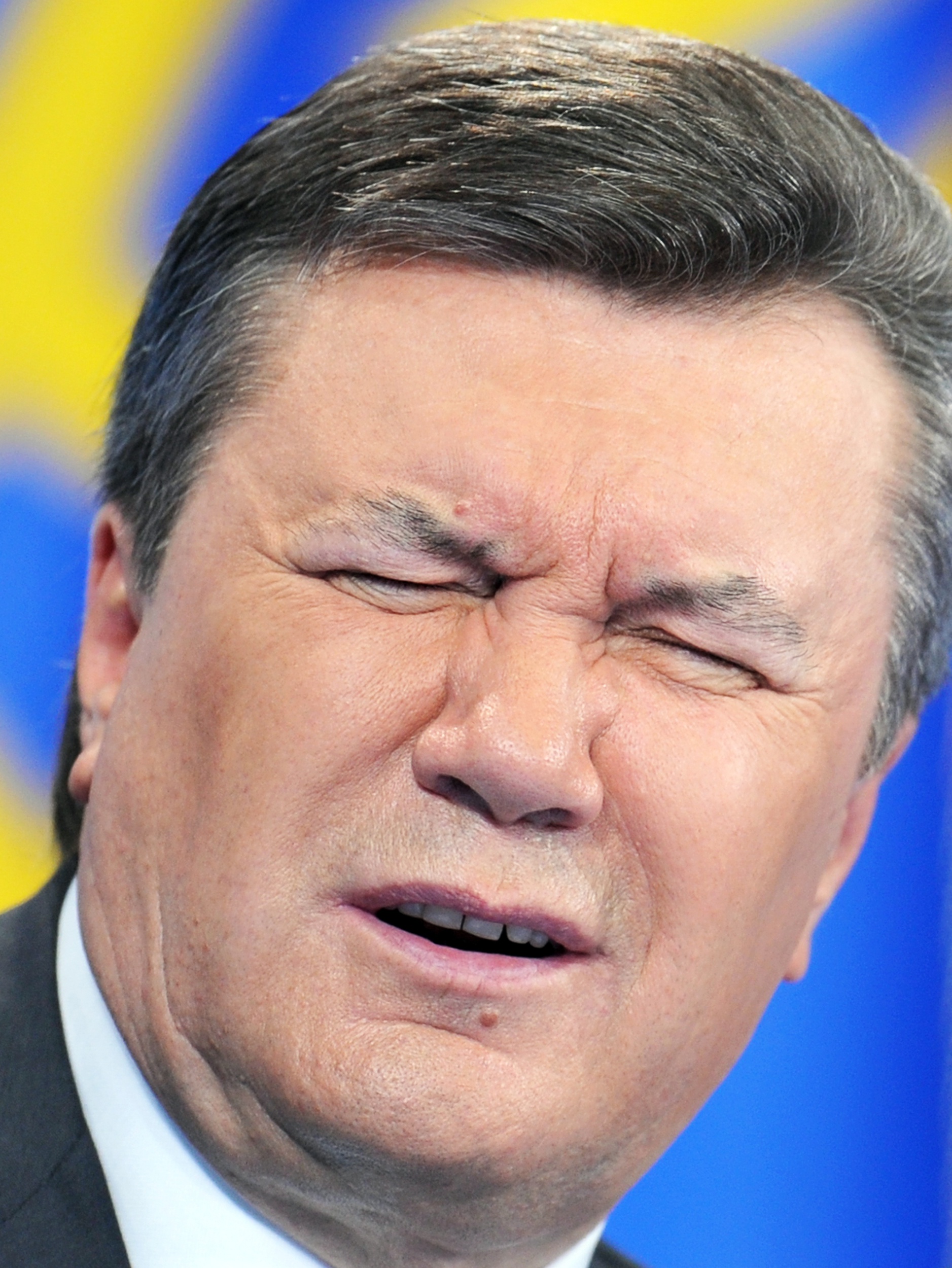 У Виктора Януковича вчера произошло кровоизлияние