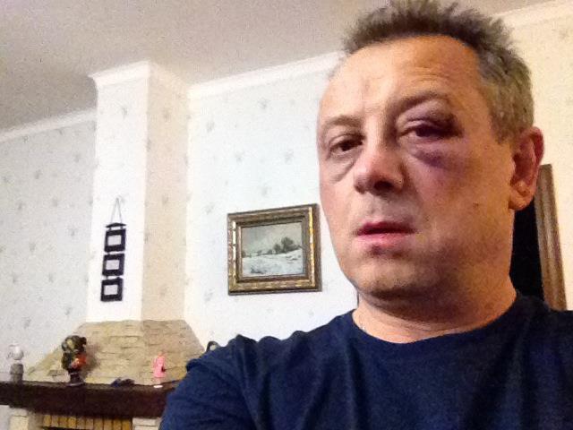 Нардепа от УДАРа Владимира Куренного избили двое неизвестных. Фото