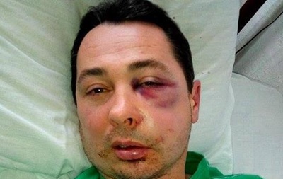 В Каховке жестоко избили депутата БПП в подъезде его же дома