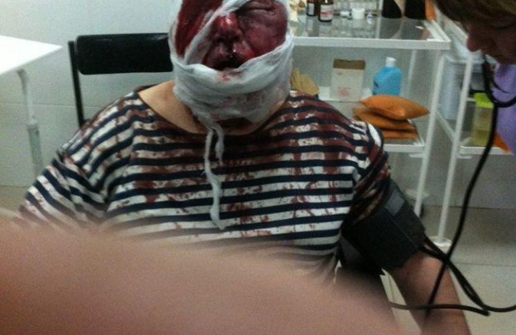 Неизвестные жестоко избили родителей депутата Харьковского горсовета Анатолия Родзинского