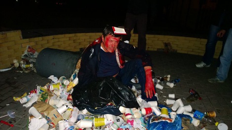 Фотофакт: Виктора Пилипишина под ЦИК бросили в мусор и облили красной краской